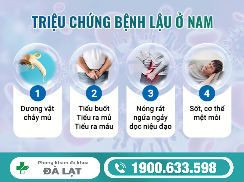 Hình ảnh minh họa